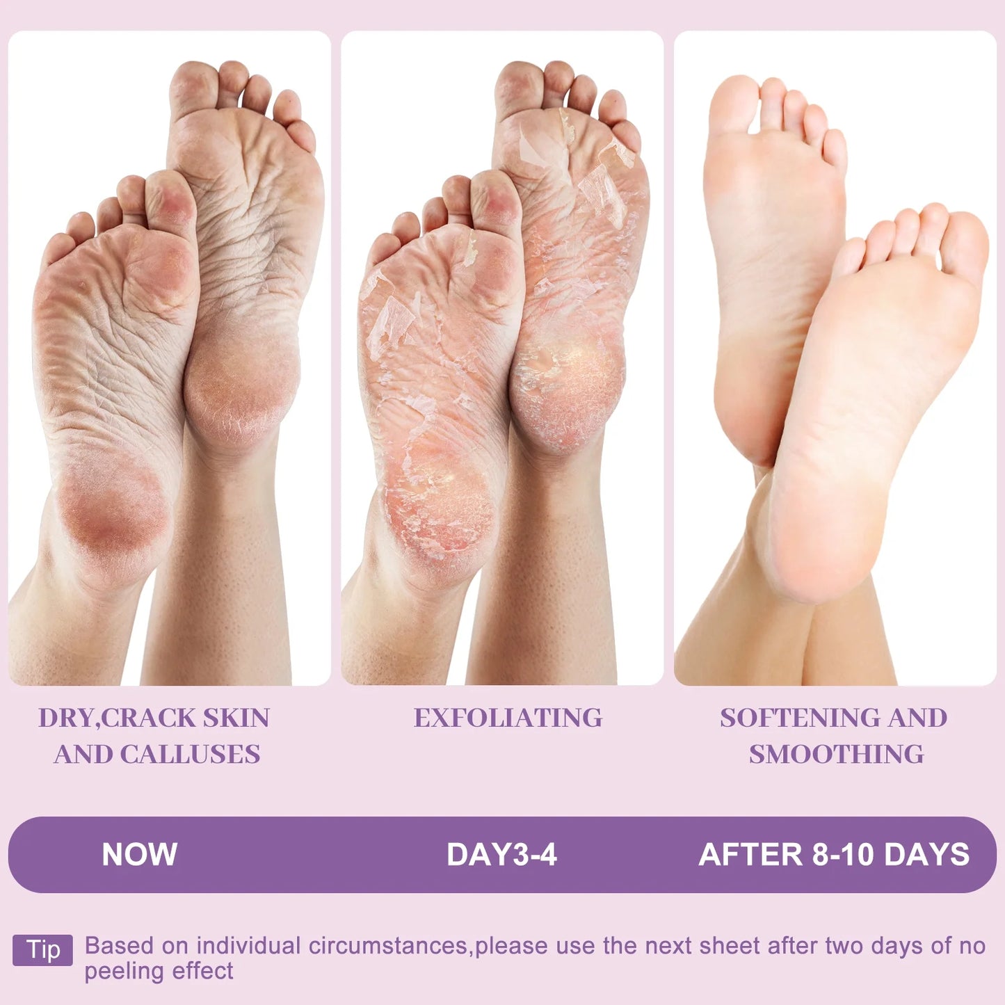 Berlaney Lavender Foot Peel Mask 3 Pairs, Calming Exfoliating Mask for Rough Feet